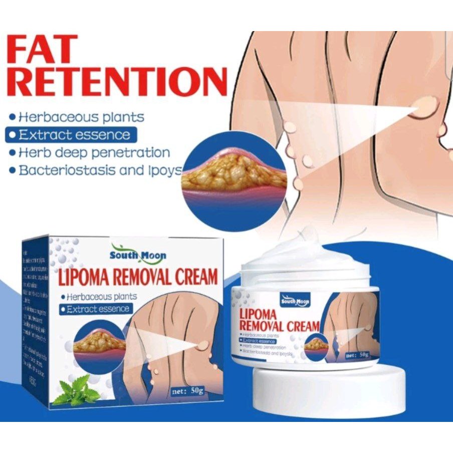 lipoma removal cream / lipoma remover krim lipoma plz