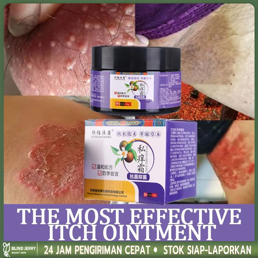 Salep gatal paling ampuh Obat gatal selangkangan salep gatal kulit yang ampuh 30g Salep gatal selang