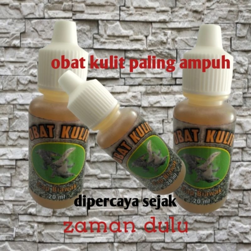 Obat Kulit Paling Ampuh Cap Biawak Mengobati Herpes Kudis Luka Bakar Cacar Kutu Air Dan Gatal Kulit