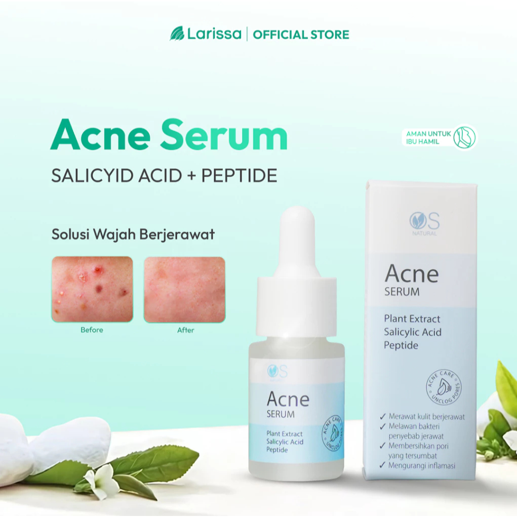 Larissa Acne Serum - Serum Wajah Untuk Mengatasi Jerawat