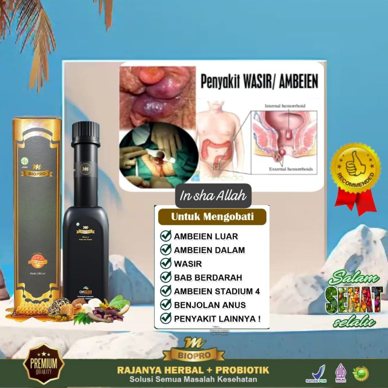 

MBIOPRO SOLUSI HERBAL AMBEIEN DAN WASIR | herbal ambeyen