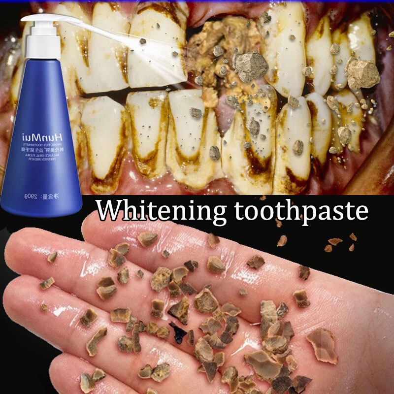 [ Asli ] pasta gigi pepsodent / pasta gigi bayi / pasta gigi anak / teeth whitening Bahan ekstrak bu