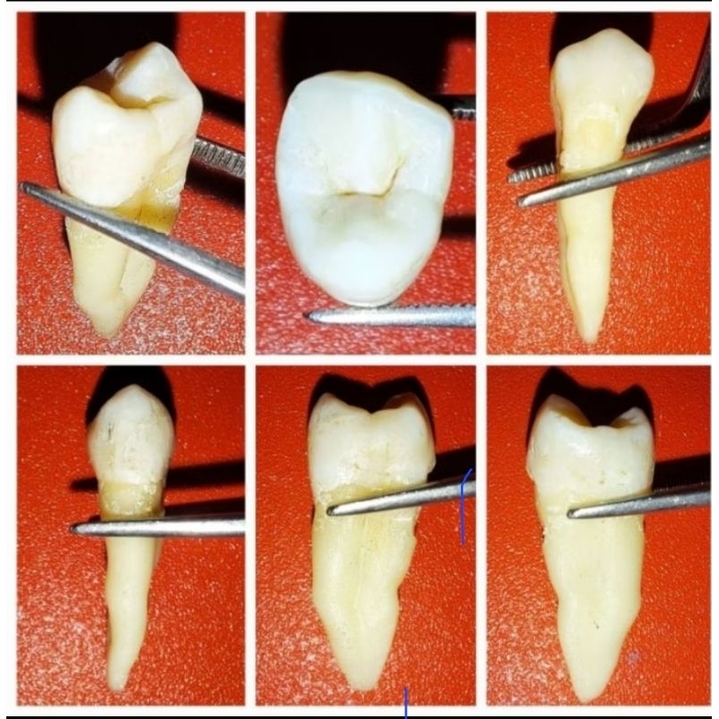 gigi asli praktikum/gigi premolar