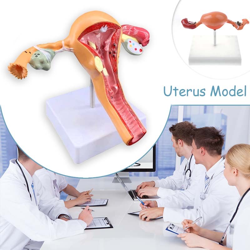Alat Peraga Uterus Dan Ovarium Normal Dan Patologi Uterus Ovarium Manekin Rahim Model Anatomy