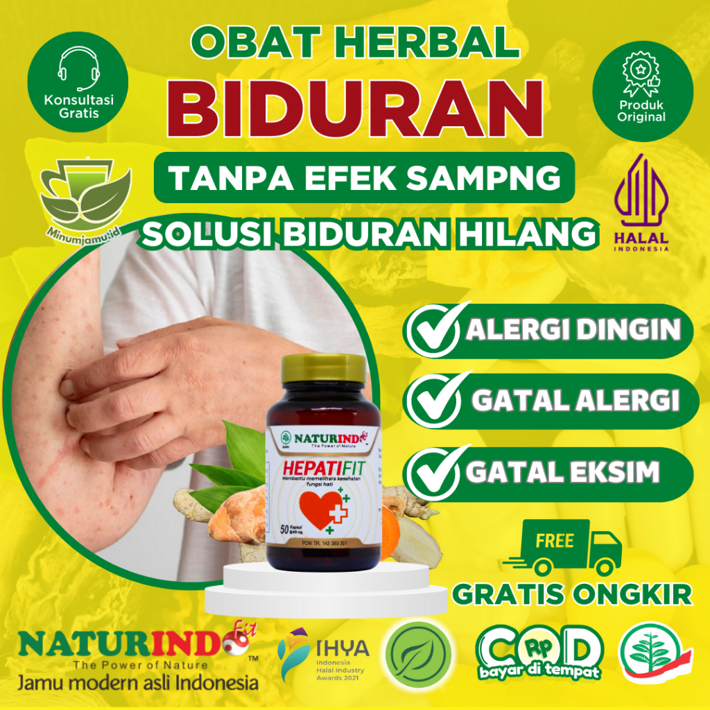 Obat Gatal Kulit Alergi Dingin Biduran Gatal Alergi Herbal Bentol Kulit, Obat Biduran Kronis, Alergi