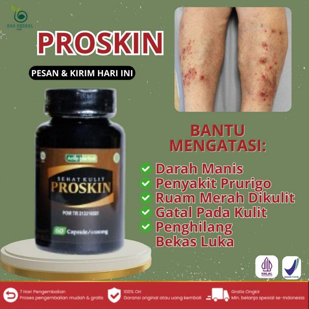 Obat Darah Manis, Obat Penyakit Prurigo, Obat Gatal Gatal Pada Kulit, Penghilang Bekas Luka, Penghil