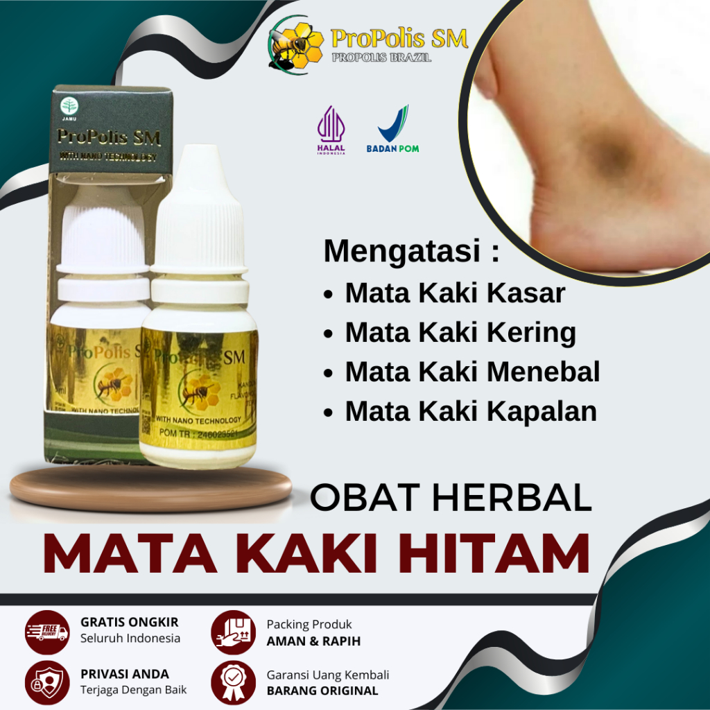 Obat Mata Kaki Hitam, Obat Pemutih Mata Kaki, Obat Cair Pemutih Mata Kaki, Obat Mata Kaki Kering dan
