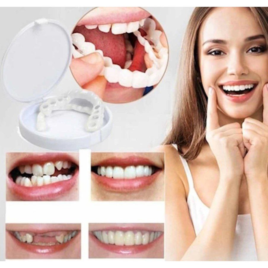 Gigi Palsu Elastis Original Ready Stok Tabs