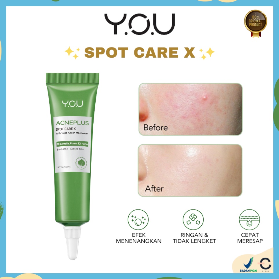 ORI BPOM YOU Acne Plus Spot Care X 15gr  Obat Totol Jerawat Centella dan Bekas Jerawat  YOU Acneplus