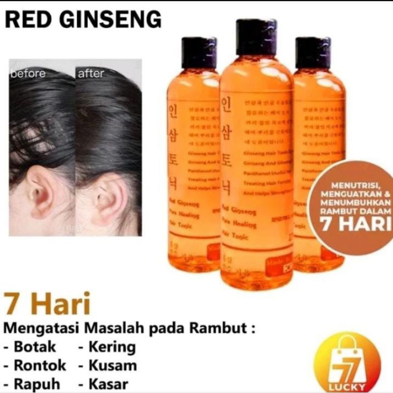 Hair Tonic Penumbuh Rambut Tonik Penyubur Atasi Rontok Botak Pitak Original Hasil Bagus menebalkan m