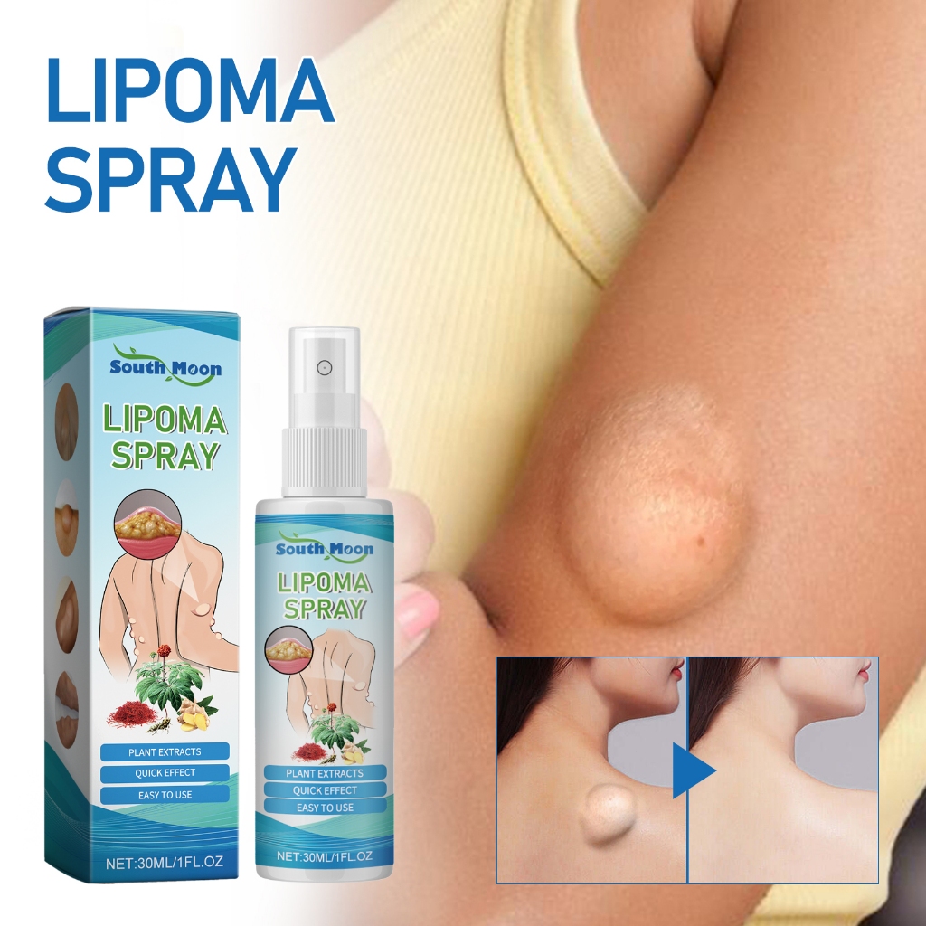 100%Ori Lipoma Cream Salep Lipoma Salep Benjolan Obat Lipoma Obat Benjolan Penghilang Benjolan
