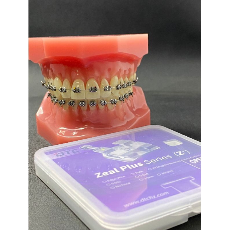 behel metal ortho zeal plus kualitas USA MIM dan tidak mudah lepas saat perawatan