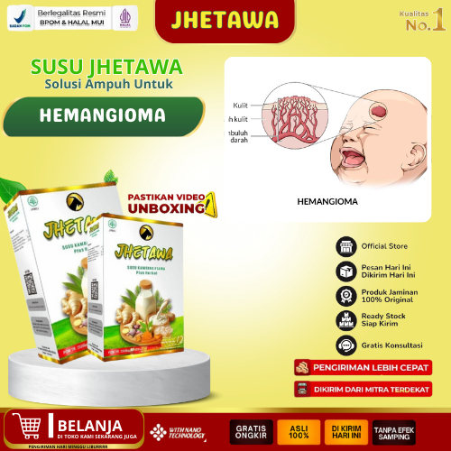 Jhetawa Obat Hemangioma, Obat Penghilang Hemangioma, Obat Gumpalah Darah Pada Bayi, Obat Menghilangk