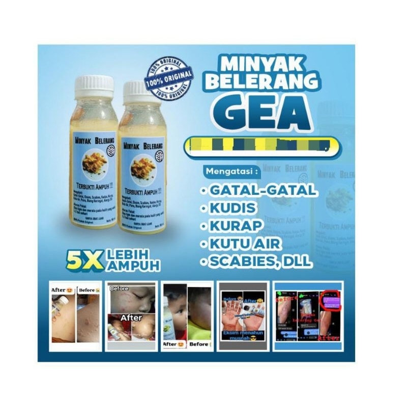 Obat  gatal MINYAK BELERANG GEA ASLI