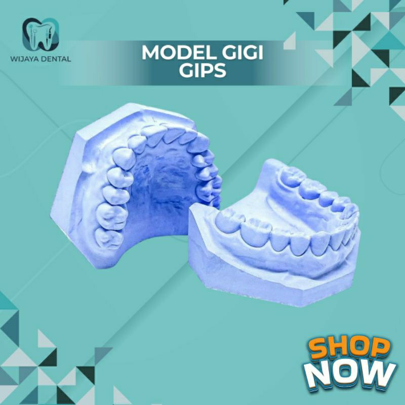 DENTAL MODEL GIGI GIPS ATAS BAWAH / MODEL STUDY GIPS / MODEL GIGI GIPSUM GYPSUM