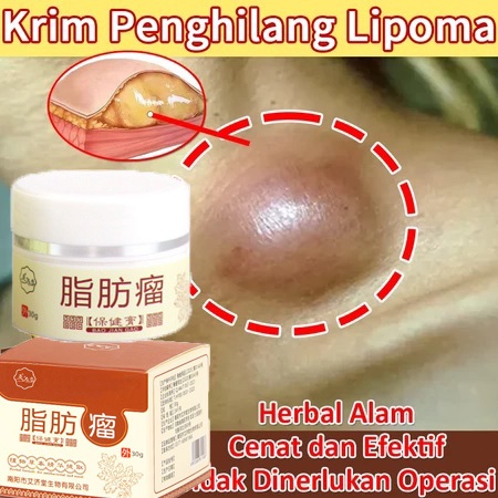 Obat Benjolan Lipoma Salep Lipoma Cream Herbal/Fibroid/Benjolan Subkutan/Leher Benjolan/Punggung Pun