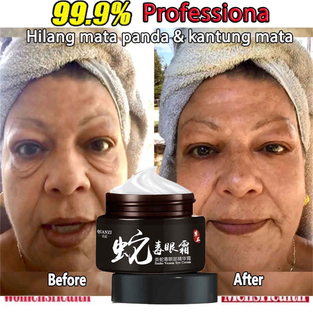 QIANZI untuk Mengurangi Dark Circle Anti-Wrinkle Anti-agging Remover Eye terhadap Puffiness Dan Bags