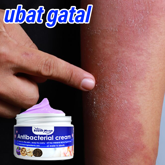 salep gatal paling ampuh salep psoriasis dermatitis gatal gatel antibakteri salep eksim salap gatal 