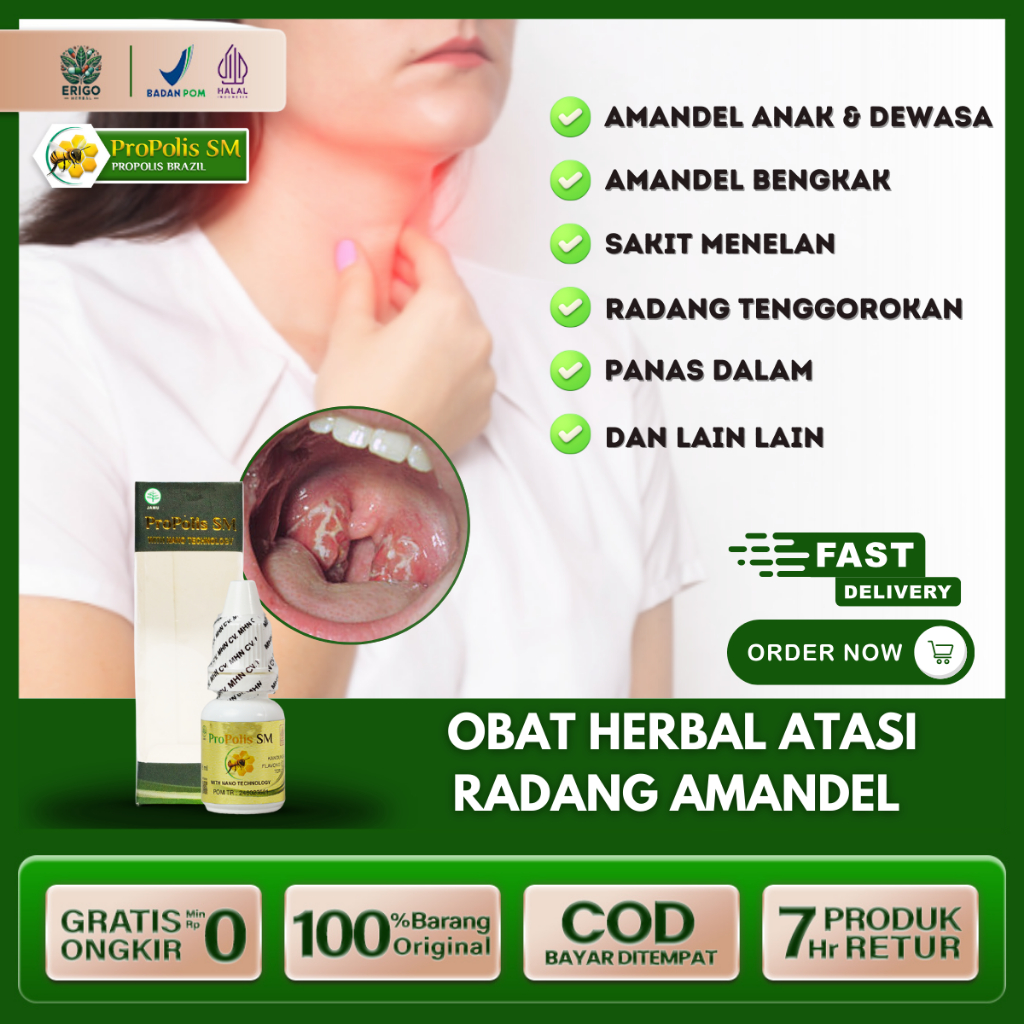Obat Amandel Benkak Nyeri Menelan Sakit Tenggorokan Radang Amandel Panas Dalam Untuk Anak Dan Dewasa