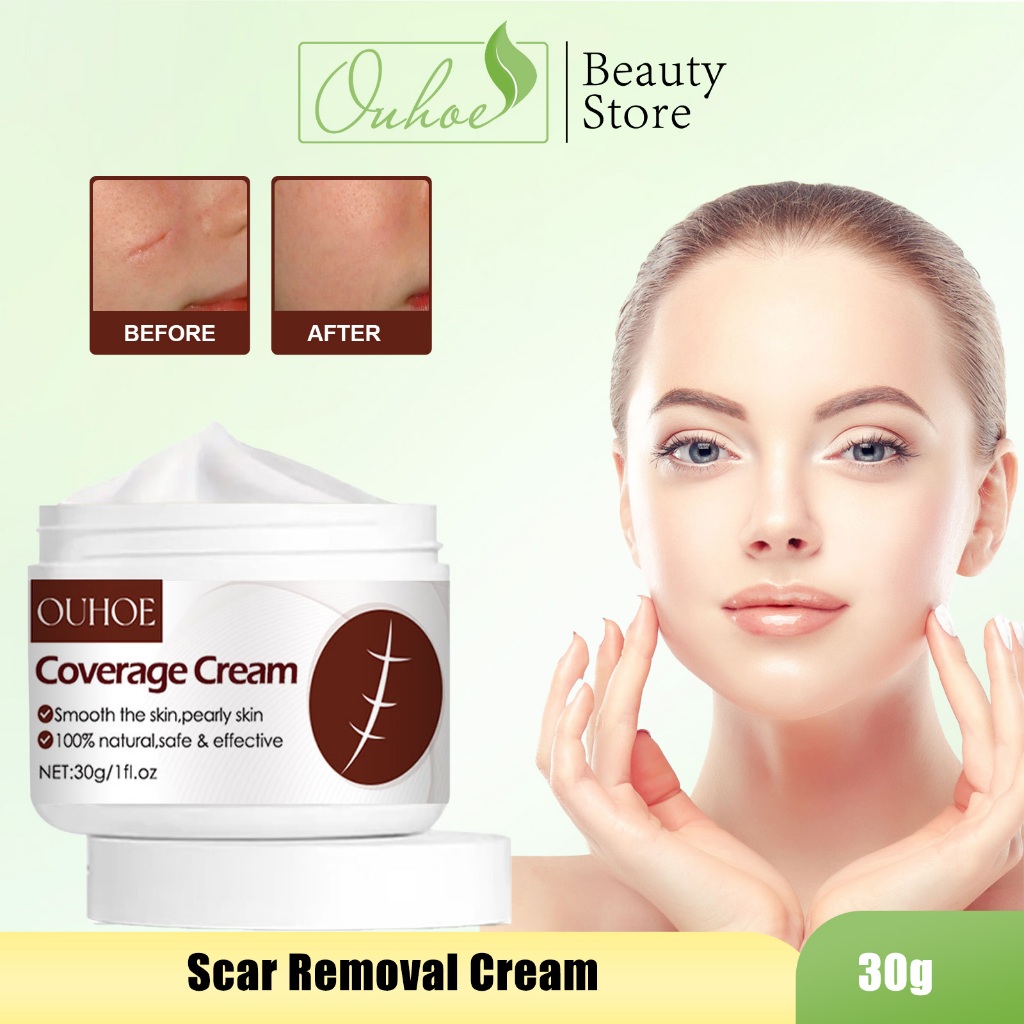 OUHOE【100%ORI/Beli 3 Gratis 2】Scar Removal Cream 30g Obat Cream Penghilang Bekas Luka Koreng Scar Re