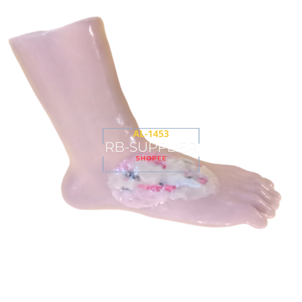 Luka Infeksi-Manikin/Manekin Kaki Luka Bahan Silikon-Alat Peraga Praktek Simulator Luka Kaki