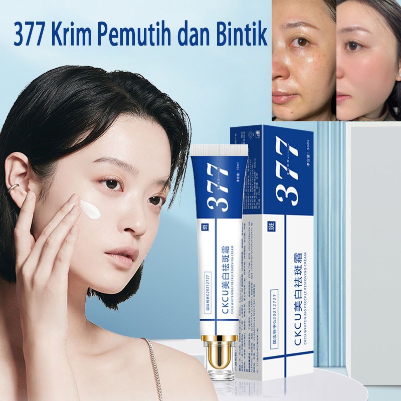 377 Pemutihan Freckle Cream Penghilang Flek Hitam Krim Pemudar Bintik Memutihkan Melembapkan