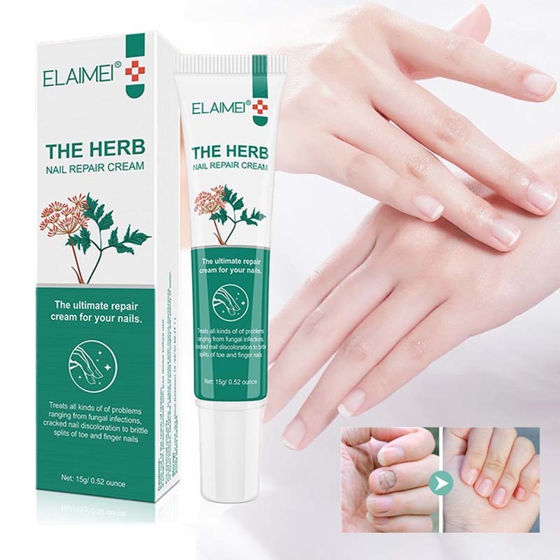 Penghilang Jamur Kuku Kaki 15g Perawatan Jamur Kuku Obat Kuku Rusak Repair Obat Jamur