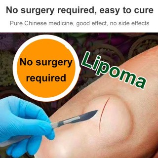 RB6 Lipoma Cream salep lipoma salep benjolan Obat Lipoma Obat Benjolan Penghilang Benjolan,