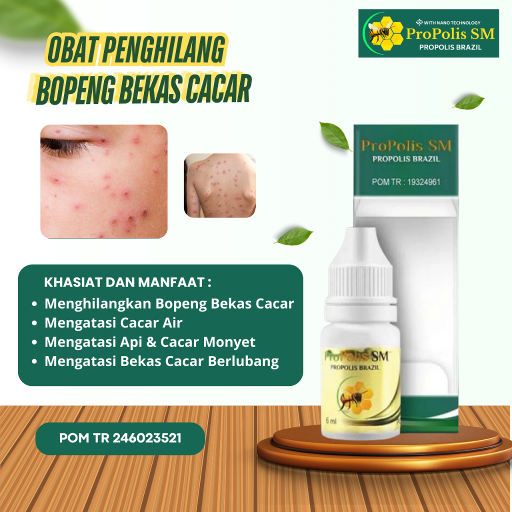 Mafaza Herbs - Obat Penghilang Bekas Cacar, Obat Bekas Cacar, Penghilang Bekas Cacar Air, Bekas Caca