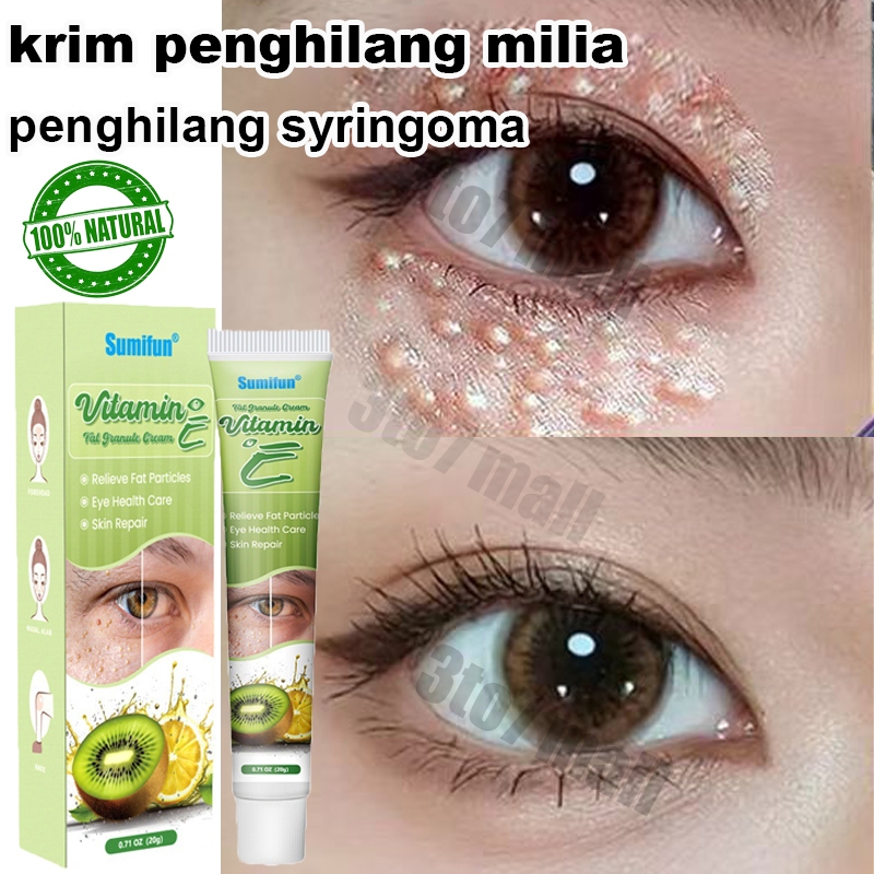 krim penghilang milia obat milia di bawah mata Milia Remover syringoma penghilang Eye Cream Benjolan