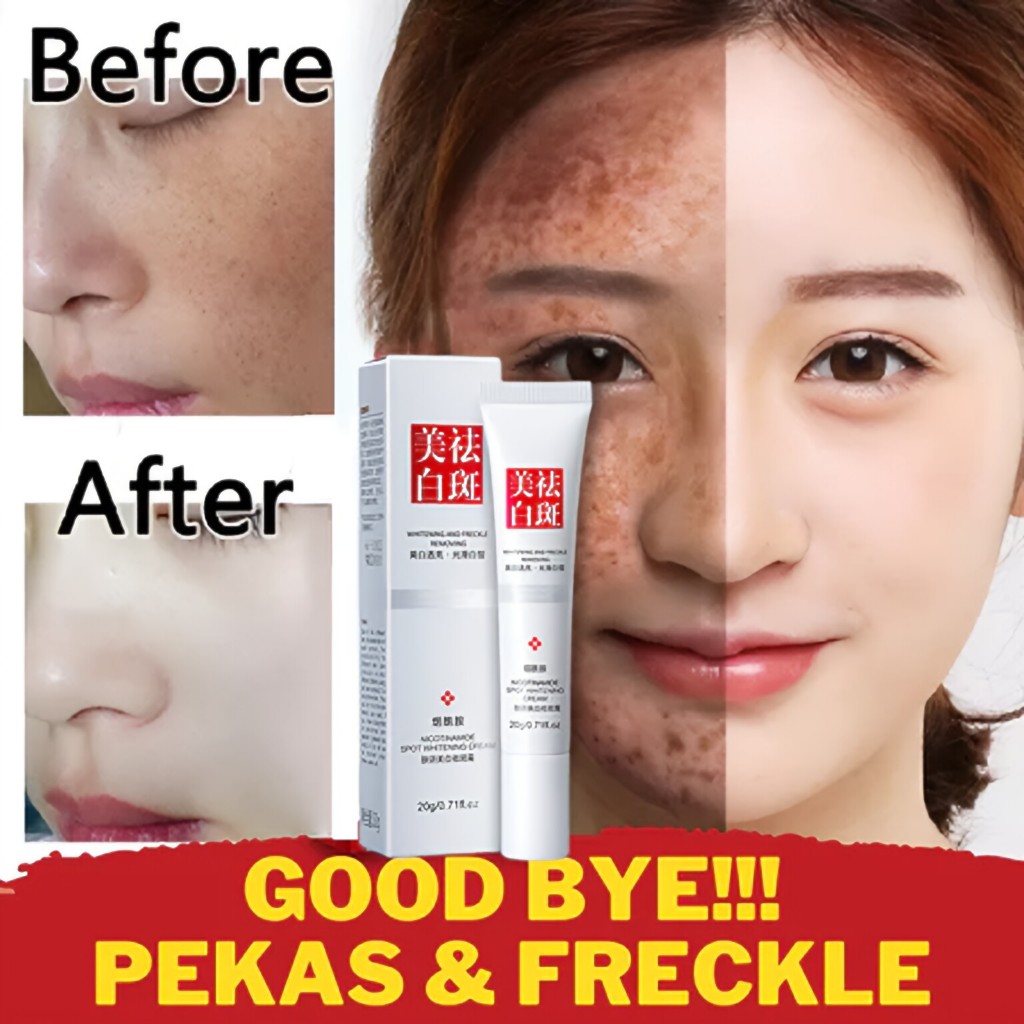 Krim Pemutih Wajah Krim Bintik Krim Pemutih Krim Bintik Krim Bintik Gelap Krim Bintik Niacinamide Pi