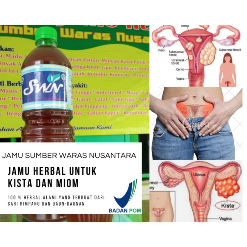 

JAMU SUMBER WARAS NUSANTARA (MIOM DAN KISTA) 600ml dan 1000ml