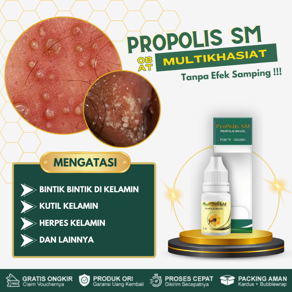 Obat Gatal Bintik Kelamin, Obat Bentol Kelamin, Obat Gatal Pada Kelamin, Obat Kutil Kelamin, HPV, Pe