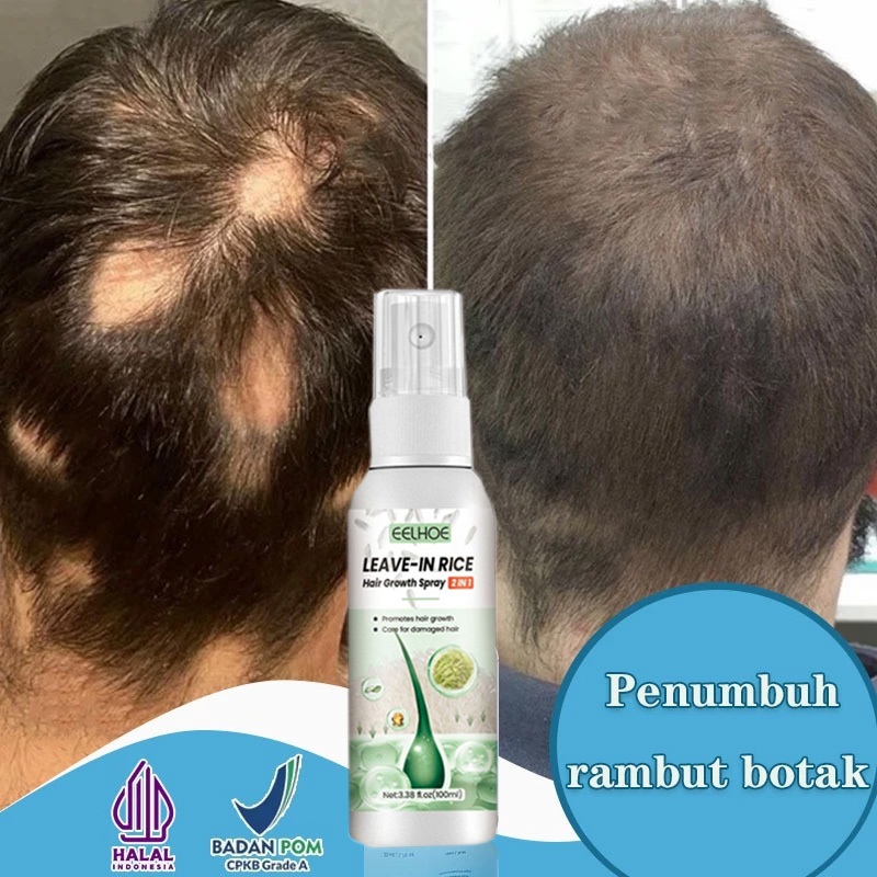 serum penumbuh Obat Botak Koin rambut botak serum  rambut rontok rusak 100ml penumbuh rambut cepat r