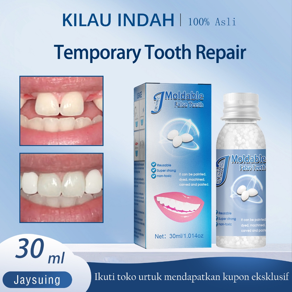 Jaysuing Gel Pengisi Gigi Palsu 10ml /Pengisian Gigi Berlubang / Pengisi Gigi Kekerasan Tinggi