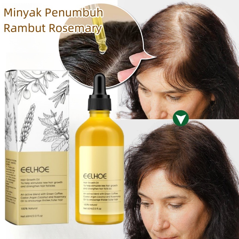 Rosemary Oil penumbuh rambut serum penumbuh rambut botak penumbuh rambut cepat hair growth serum unt