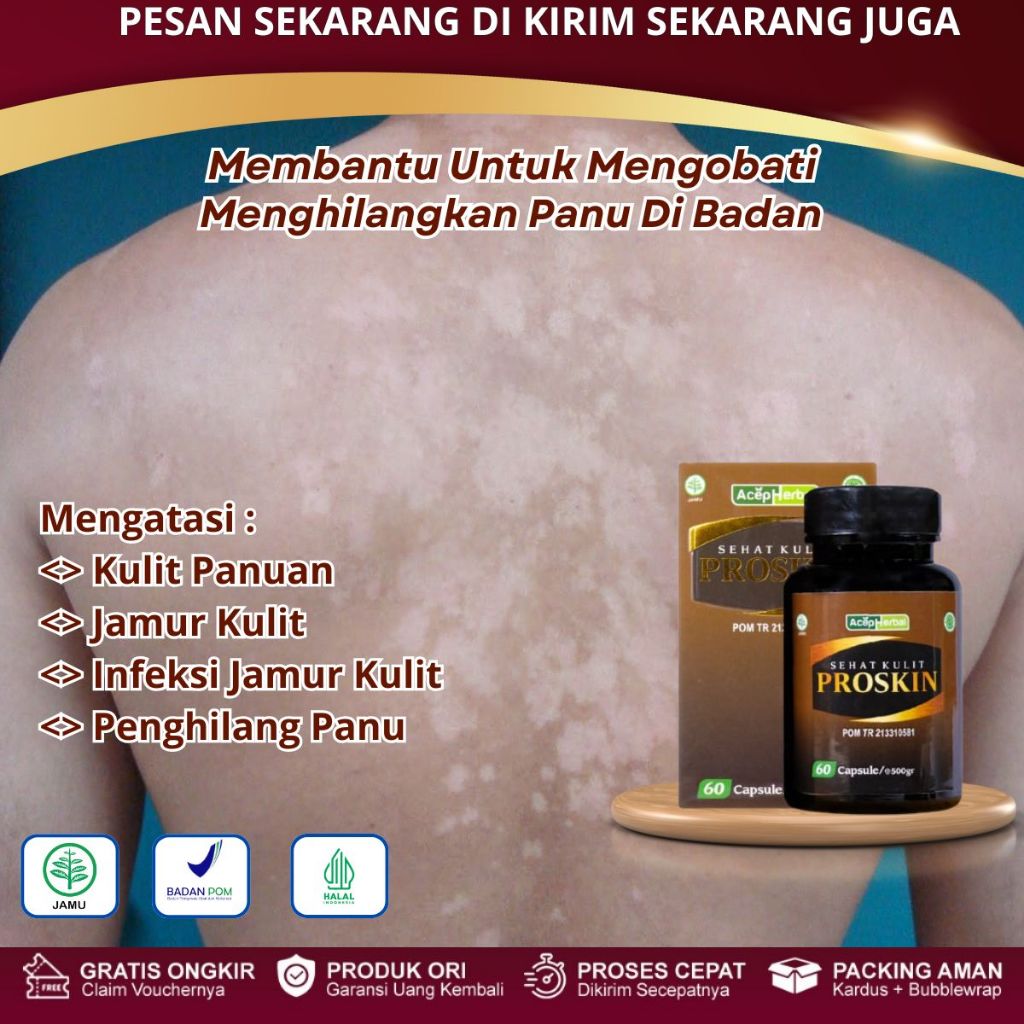 Proskin - Obat Penghilang Panu, Panu Di Wajah, Panu Di Badan, Obat Hapuran, Panu Pada Anak