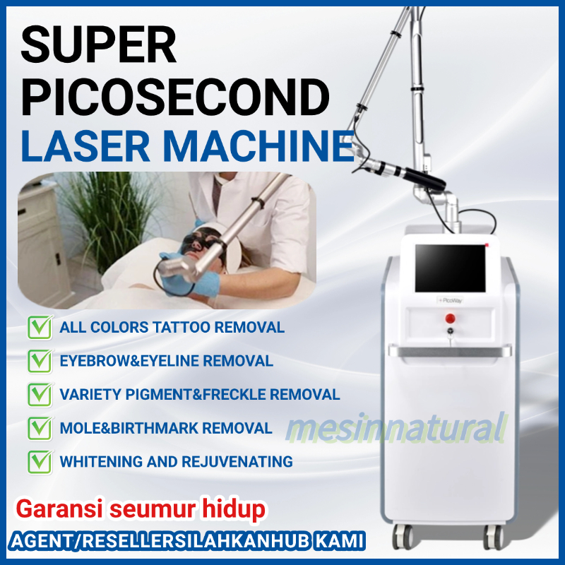 Super Picosecond Laser Alat laser penghilang flek laser black doll laser penghilang tahi lalat alat 