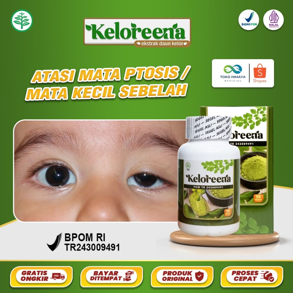 KELOREENA Obat Mata Ptosis Mata Kecil Sebelah Mata Menonjol Malas Kelopak Mata Turun / Bengkak