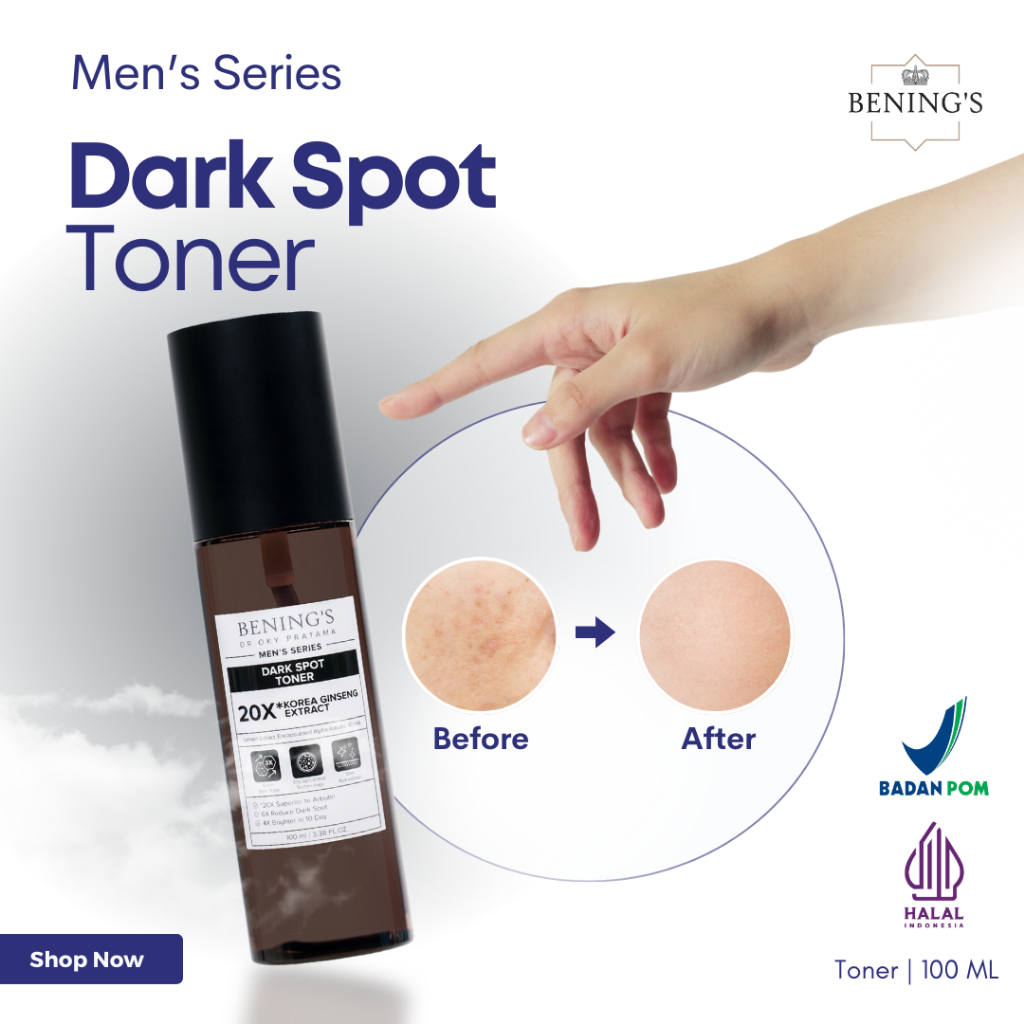 Bening's Dark Spot Toner Men Untuk Mencerahkan Wajah Face Toner Flek Hitam Bening Skincare