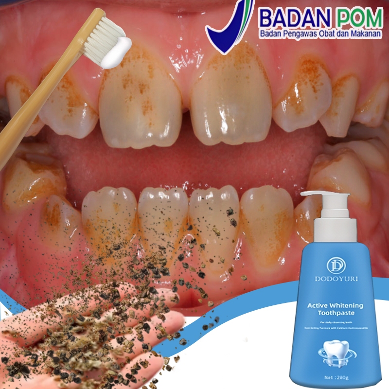 Odol pemutih gigi dan karang gigi Perontok karang gigi paling ampuh Pasta gigi pemutih penghilang ka