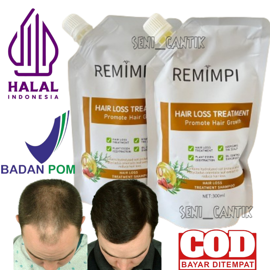 shampo rambut rontok remimpi  berketombe bpom 300 ml