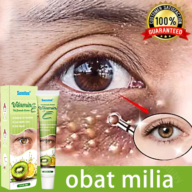 ori krim penghilang milia syringoma xanthelasma butiran lemak sekitar mata