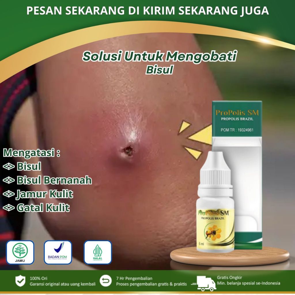 Propolis Sm - Obat Bisul, Bisul Bernanah, Penghilang Bisul Di Badan, Obat Tetes Bisul