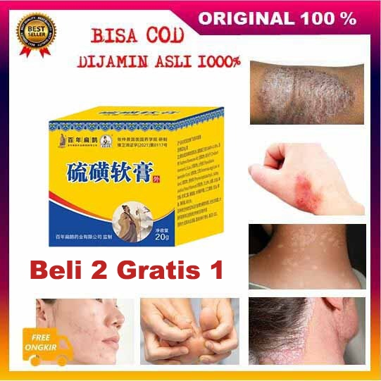 Salep Lumbar Salep Eksim Kering Paling Ampuh Salep Eksim Paling Ampuh krim anti gatal Krim Anti Gata