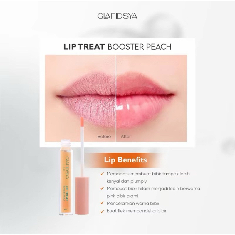 GLAFIDSYA - Lip Treatment Glafidsya