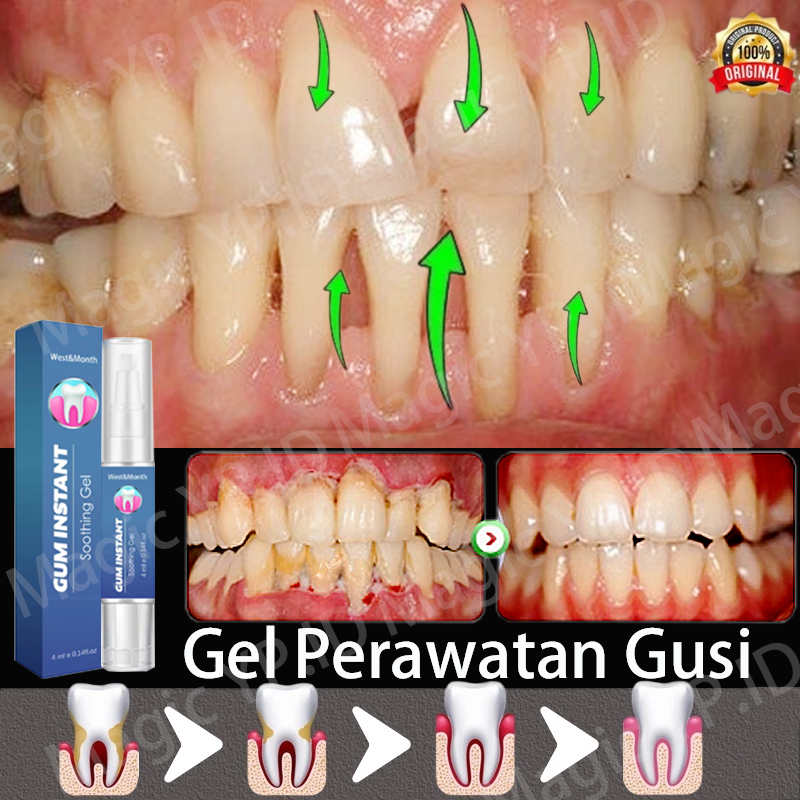 gumshield obat gusi bengkak obat sakit gigi ampuh obat sakit gigi paling penguat gigi goyang gigi go