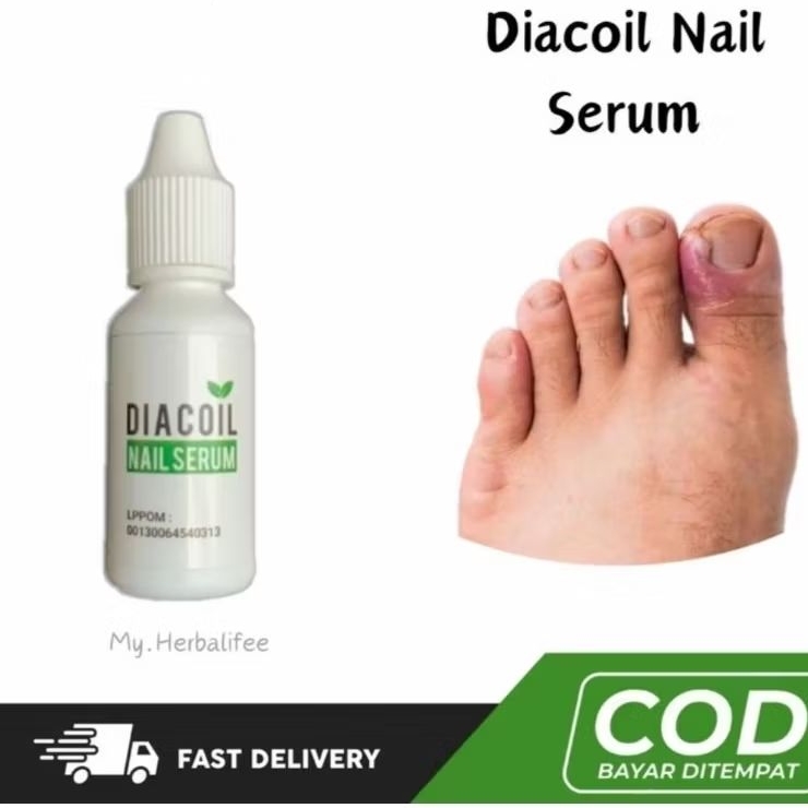 DIACOIL NAIL SERUM - Atasi Kuku Bernanah , Cantengan , Jamur Kuku ORIGINAL 100%