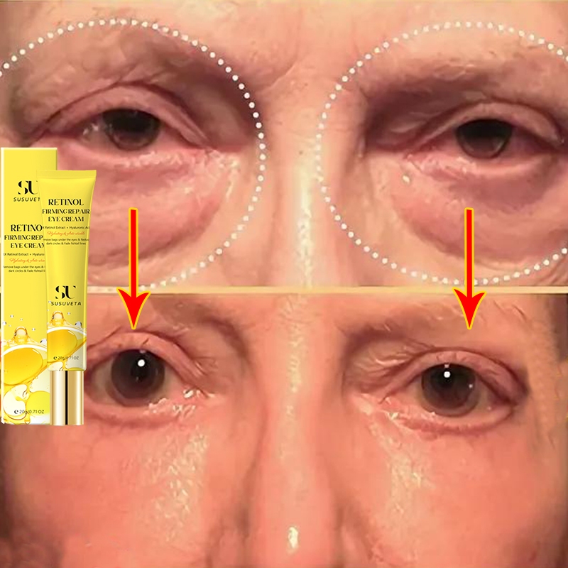 Eye cream kantung mata penghilang kantung mata panda dan kantung mata ampuh penghilang mata panda 20