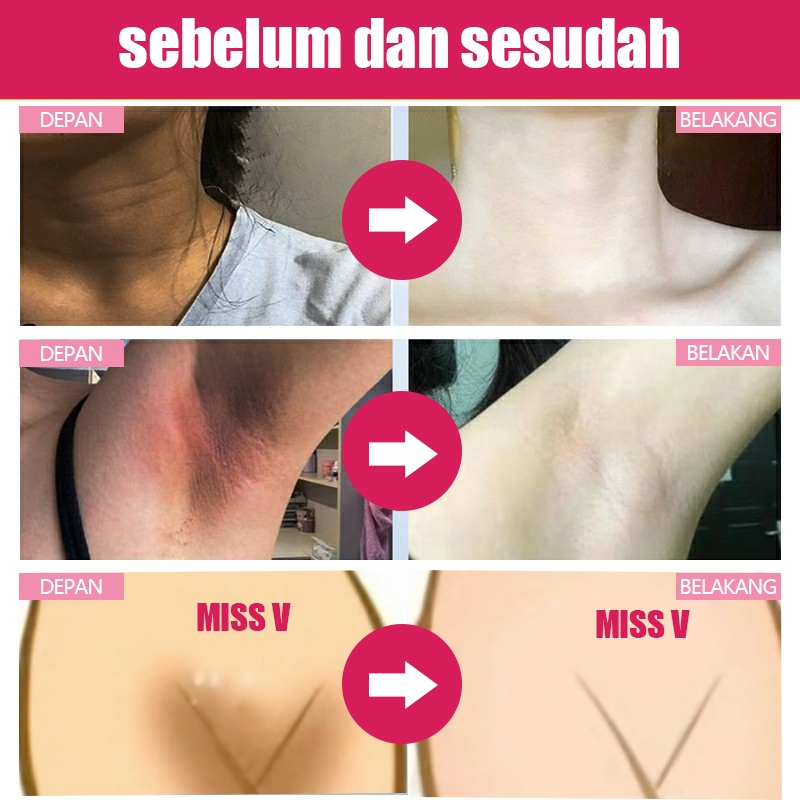 RB Memutihkan selangkangan hitam cream pemutih selangkangan bpom pemutih selangkangan ampuh 20g